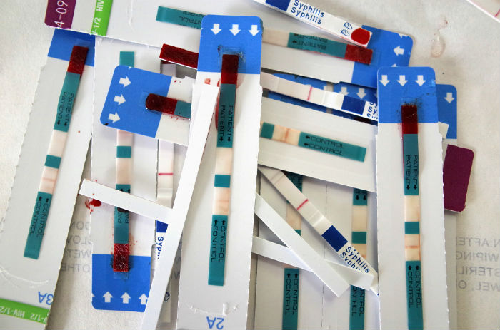 Kenya Flags Off Shipment of Vital HIV Supplies to Ensure Continuity of Care Nationwide